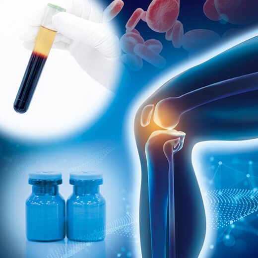 バイオセラピー(PFC-FD™)外来