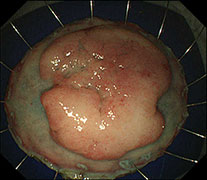 病理検査時の写真