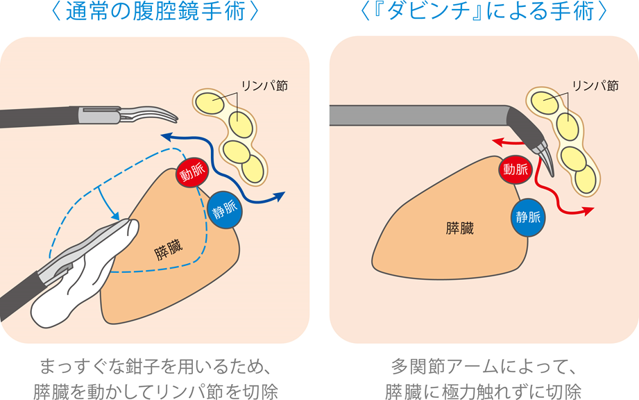 モーションスケーリング機能の様子の写真