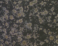 癌細胞を培養のようす