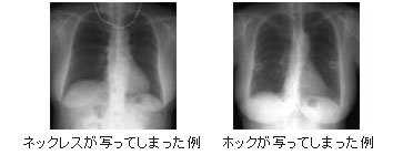 ネックレスやホックが写ってしまった例