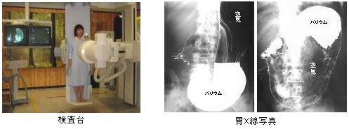 胃透視検査のようす