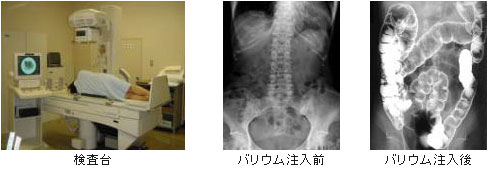 注腸検査のようす